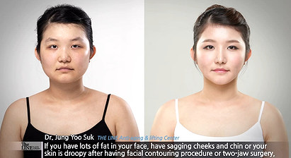 Face Contouring Surgery-The LINE Plastic Surgery Clinic