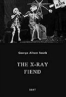The X-Rays