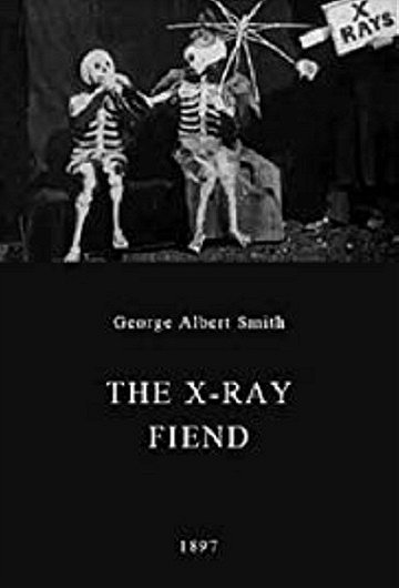The X-Rays