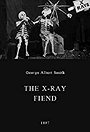 The X-Rays