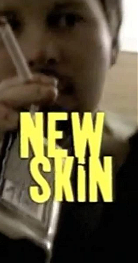 New Skin