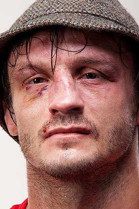 Brad Pickett