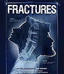 Fractures