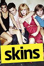 Skins (US)