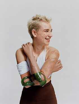 Beatrice Vio