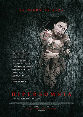 Hipersomnia