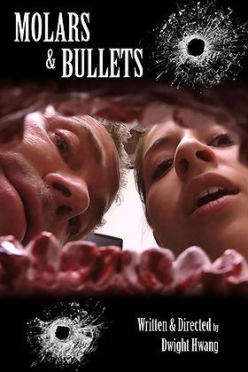 Molars  Bullets
