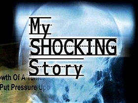 My Shocking Story