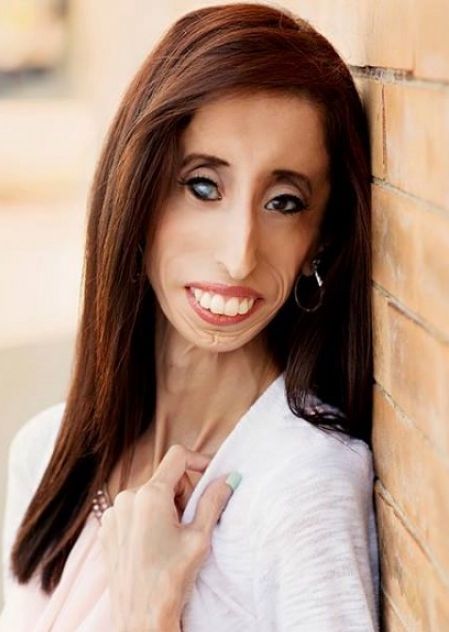 Lizzie Velasquez
