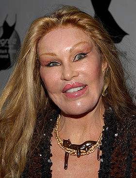 Jocelyn Wildenstein