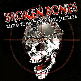 Time for Anger, Not Justice