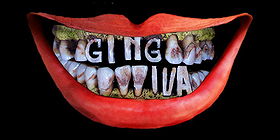 Gingiva