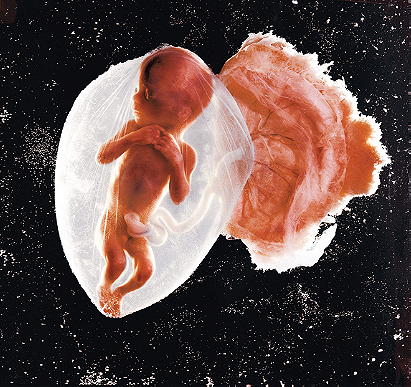 Fetus, 18 Weeks
