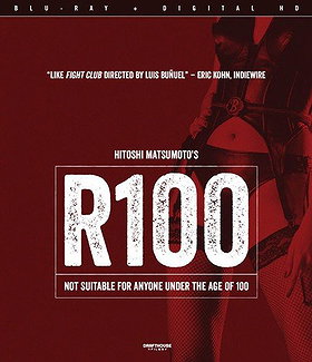 R100 