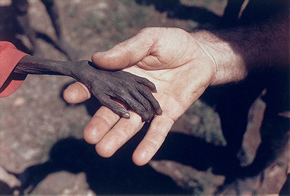 Missionary holding hand of starving child in Uganda