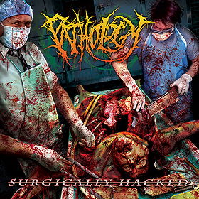 Surgically Hacked
