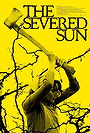 The Severed Sun
