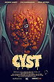 Cyst